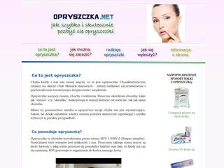 Podgląd opryszczka.net