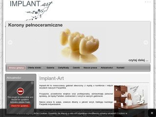 Podgląd implant-art.com.pl